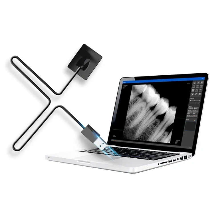 Capteur de radiographie dentai - Medical Supplies avis et prix